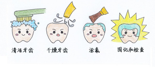 登录 注册 无障碍阅读         涂后事宜: 涂氟后,氟化物需在牙齿上短