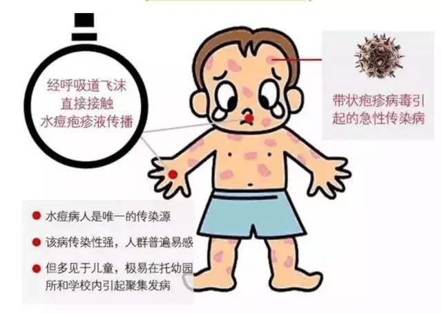 3. 水痘的症状有哪些?