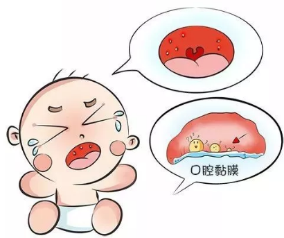 宝宝突然发高烧,喉咙长泡泡得了疱疹性咽峡炎怎么办?一篇读懂